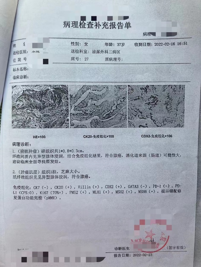 “尿血后，我失去半个膀胱，理赔12次拿到50多万”