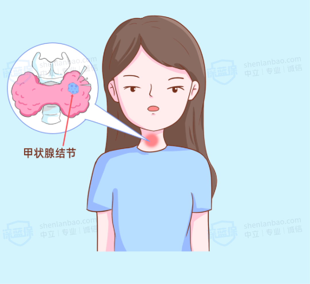 甲状腺结节会变成癌吗？这7类人要特别注意（附甲癌投保指南）